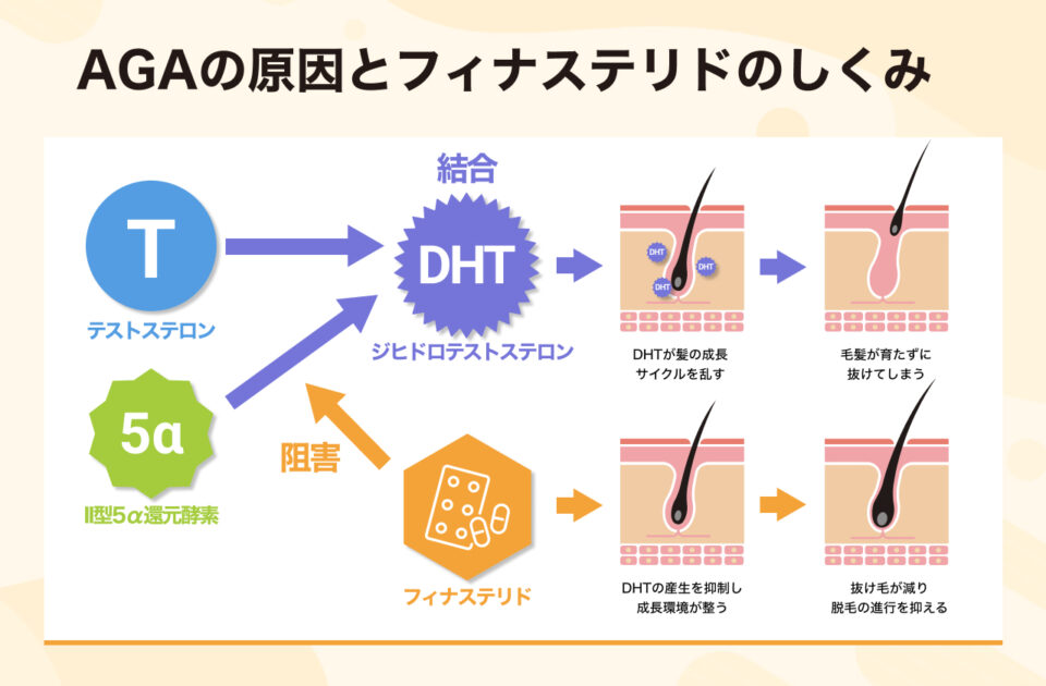 フィナステリドの作用のしくみ