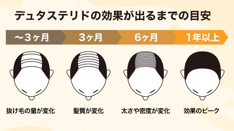 デュタステリドの服用で期待できる効果