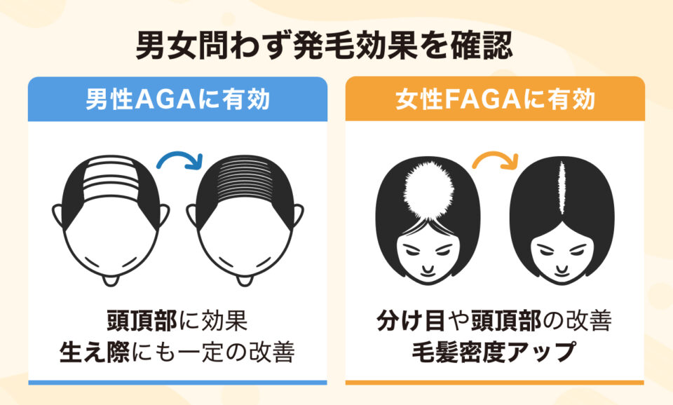 男女問わず発毛効果を確認