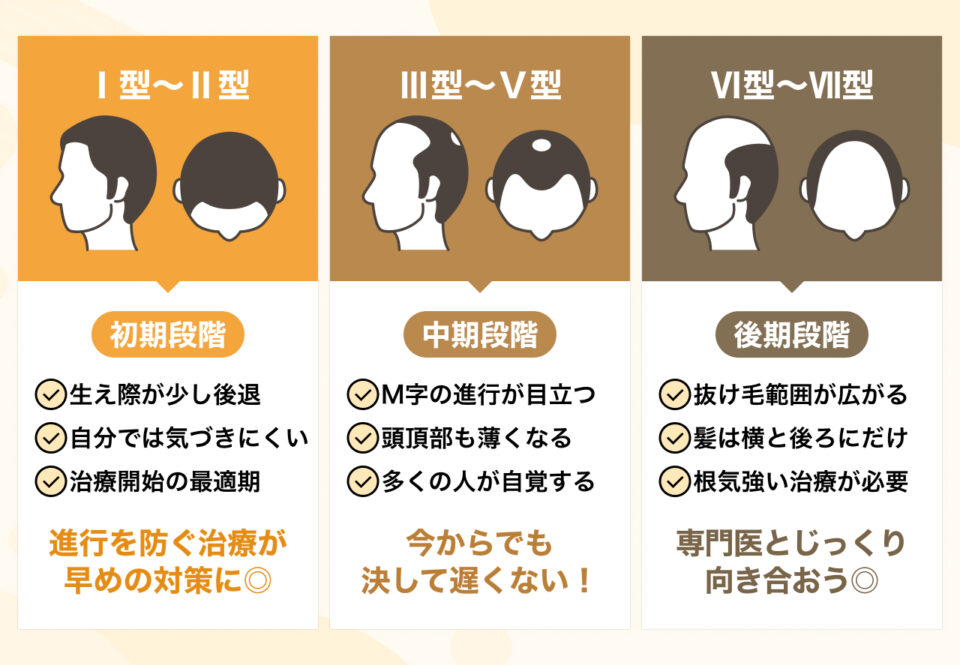 ハミルトン・ノーウッド分類で知るAGAの進行度