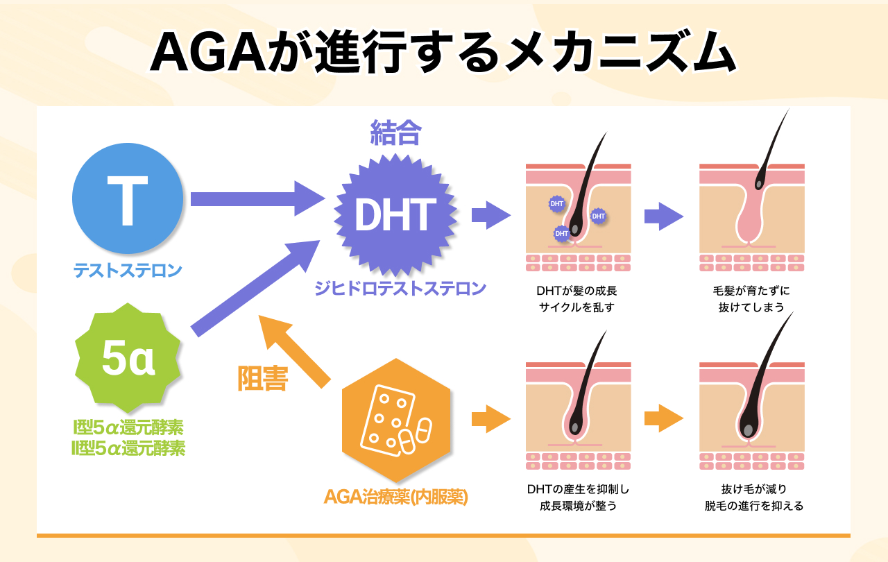 #6_AGAの原因と進行性|なぜ早期治療が重要?