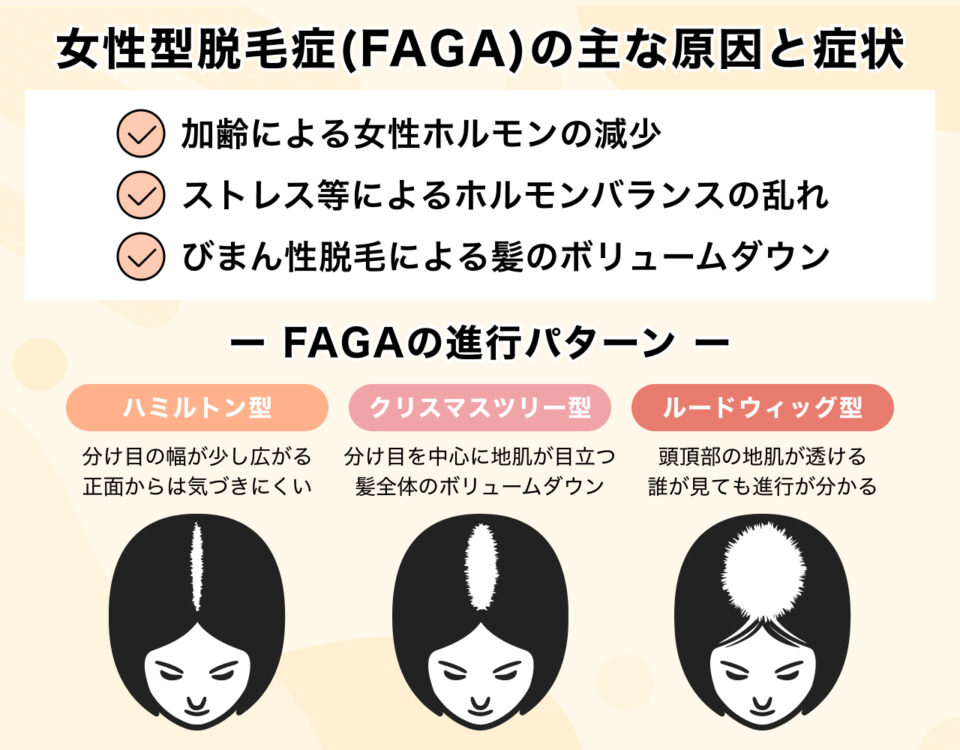 女性型脱毛症(FAGA)の主な原因と症状