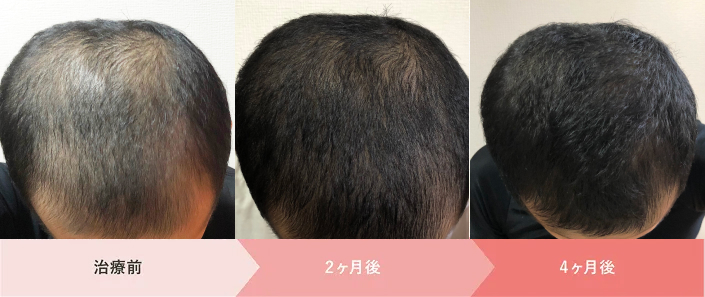 クリフォア_30代