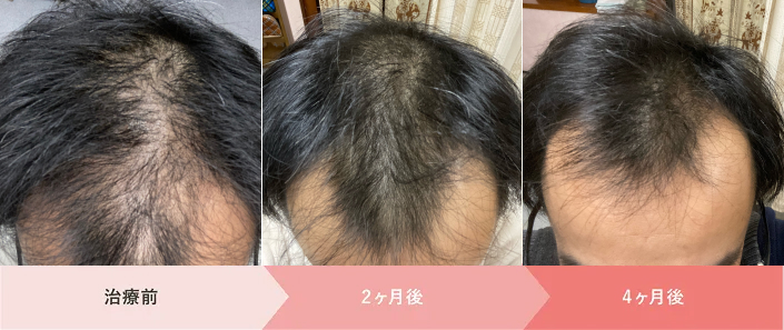 クリフォア_40代