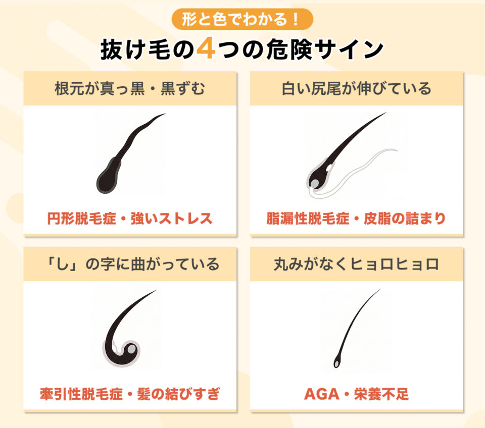 白い塊だけじゃない!毛根の形と色でわかる脱毛症のリスク