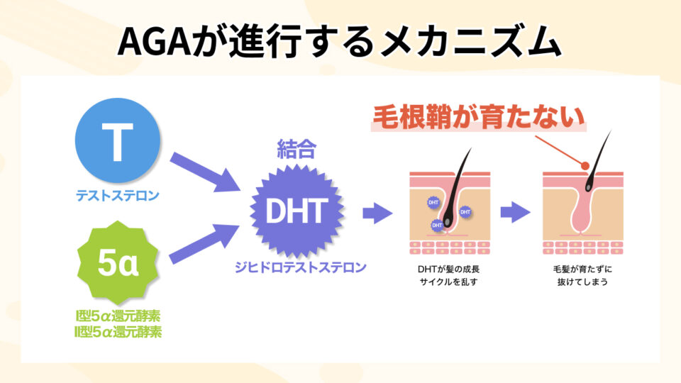 毛根鞘が成長しない根本原因「AGA」の仕組み