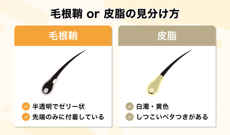 毛根鞘が巨大化する原因と皮脂との見分け方